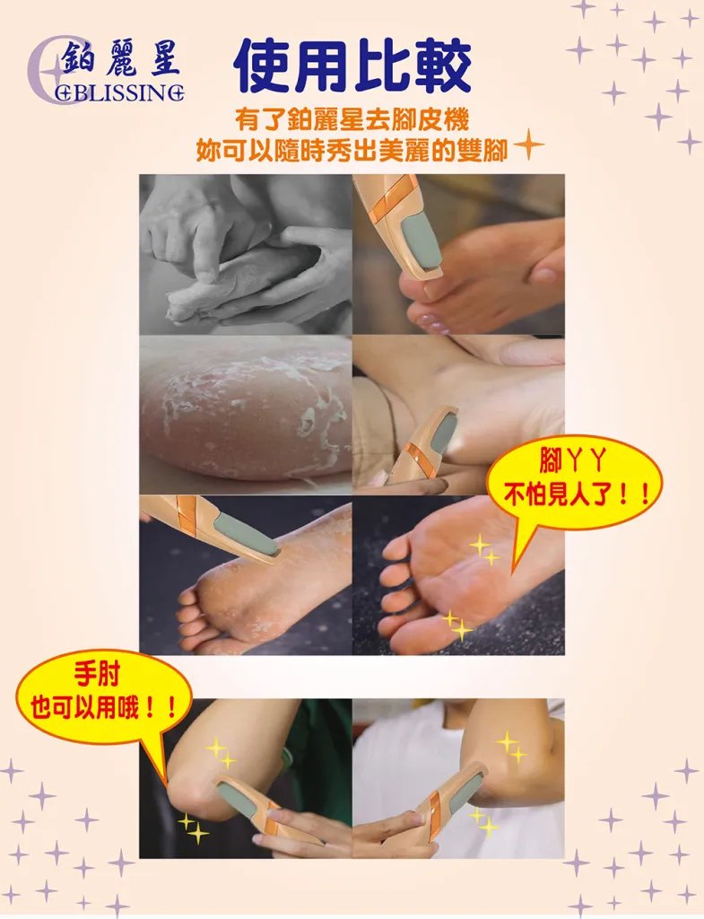 【鉑麗星】電動滾輪去硬皮機 磨腳皮機 1組附USB線 美腳美腿法寶